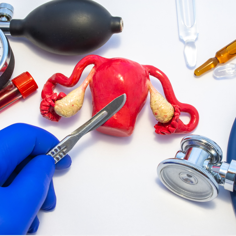 Khám dị tật buồng tử cung